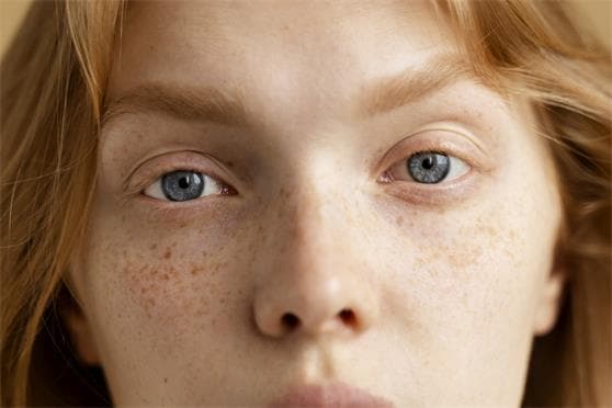 Dark Spots